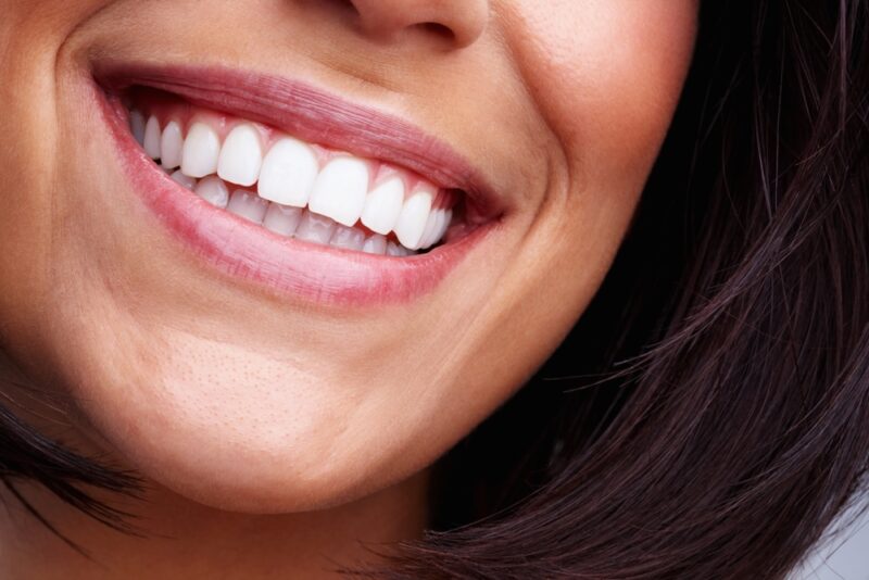 Cosmetic Dentist Little Rock